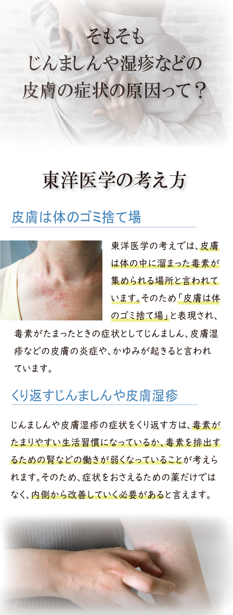 そもそも蕁麻疹や湿疹などの皮膚の症状の原因って？、東洋医学の考え、ヒフは体の込捨て場、繰り返す蕁麻疹やヒフ湿疹、皮膚トラブルの解説